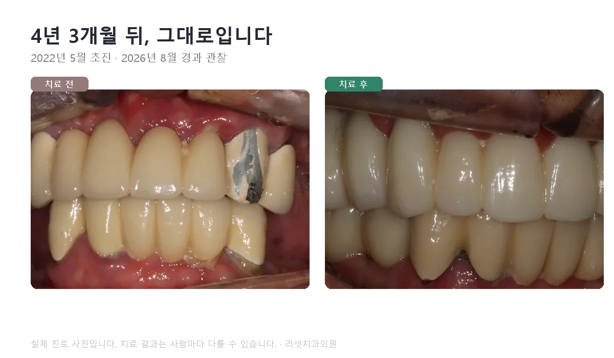 2022년 5월 초진, 2026년 8월 경과 관찰