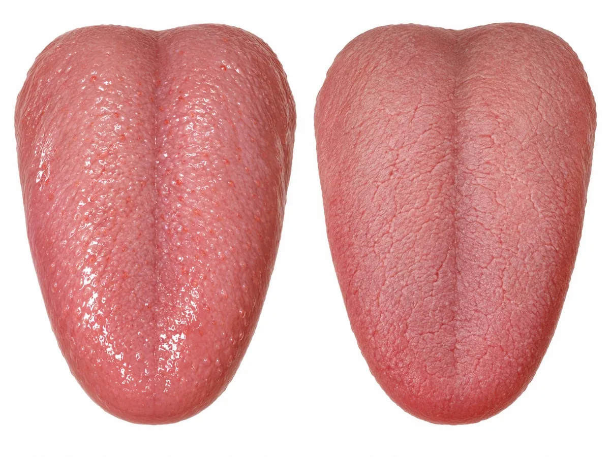 마른 혀는 작은 자극에도 예민해집니다.