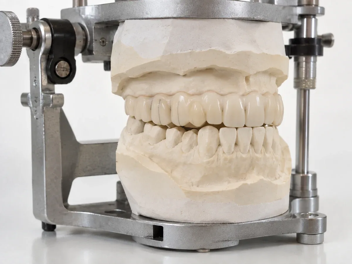 Temporary teeth are worn and adjusted first.