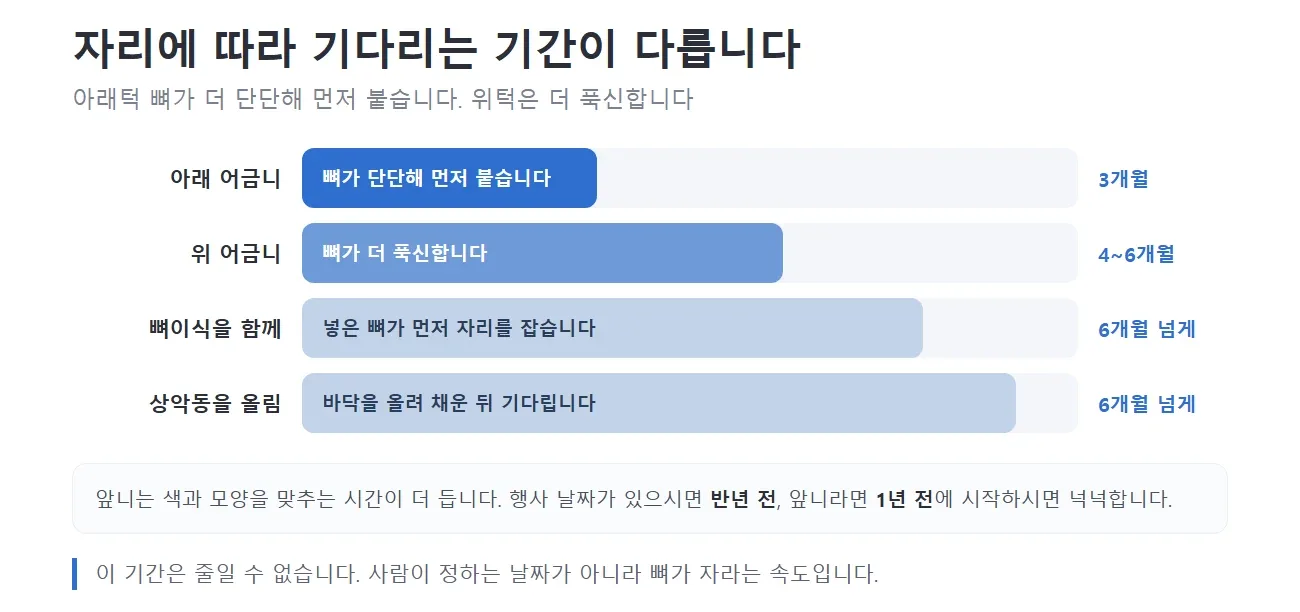 아래턱·위턱·뼈이식·상악동 거상에 따라 기다리는 기간이 달라지는 것을 막대로 비교한 그림 — 리셋치과의원
