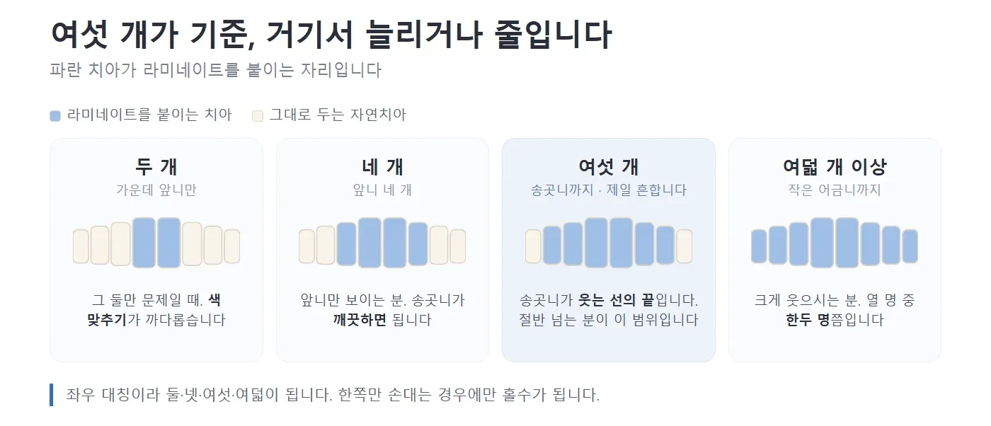 라미네이트를 두 개·네 개·여섯 개·여덟 개 할 때 어느 치아에 붙이는지 보여 주는 그림 — 리셋치과의원
