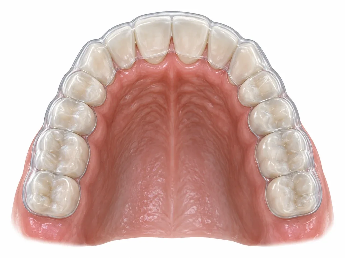 The most widely used option is a device worn in the mouth.